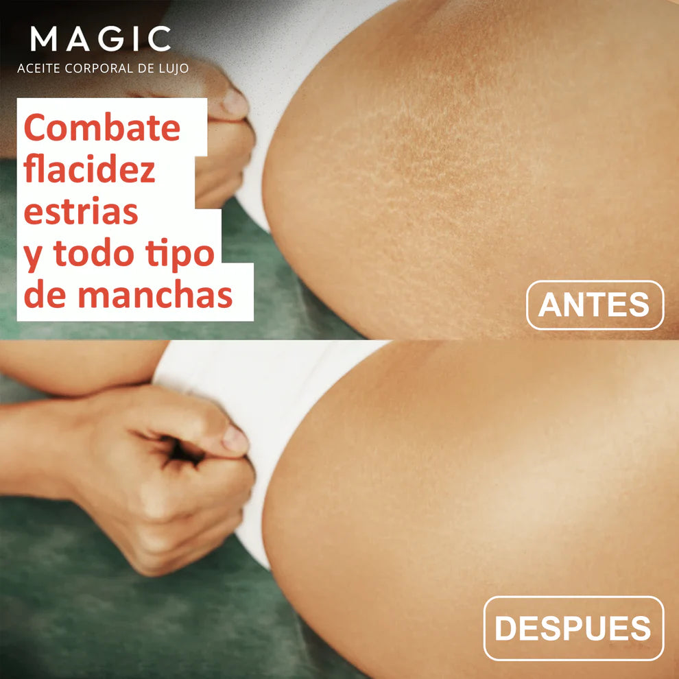 2x1 Aceite Original Corporal Magic™