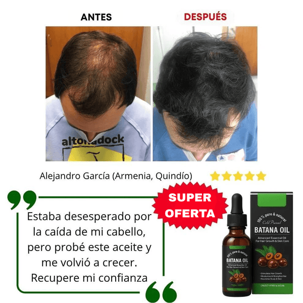 Aceite Milagroso para Cabello